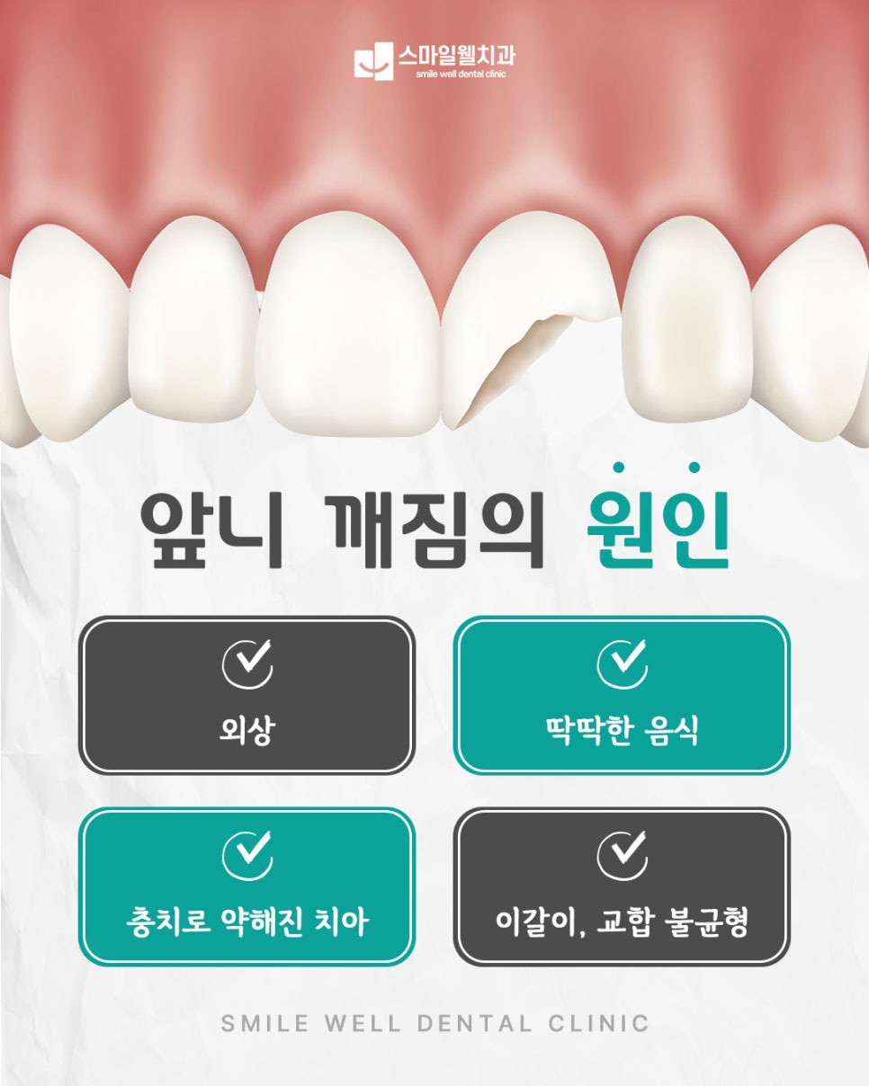 앞니가 깨졌어요, 레진과 크라운 중 어떤 치료가 적합할까요?