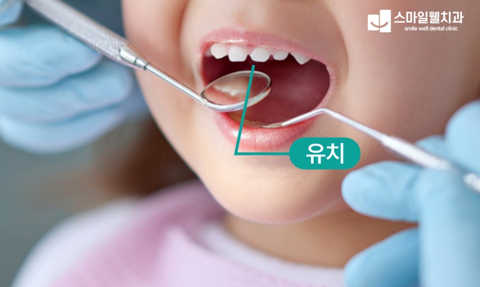 유치 치과 검진, 언제부터 해야 할까요? [시기·중요성 정리]