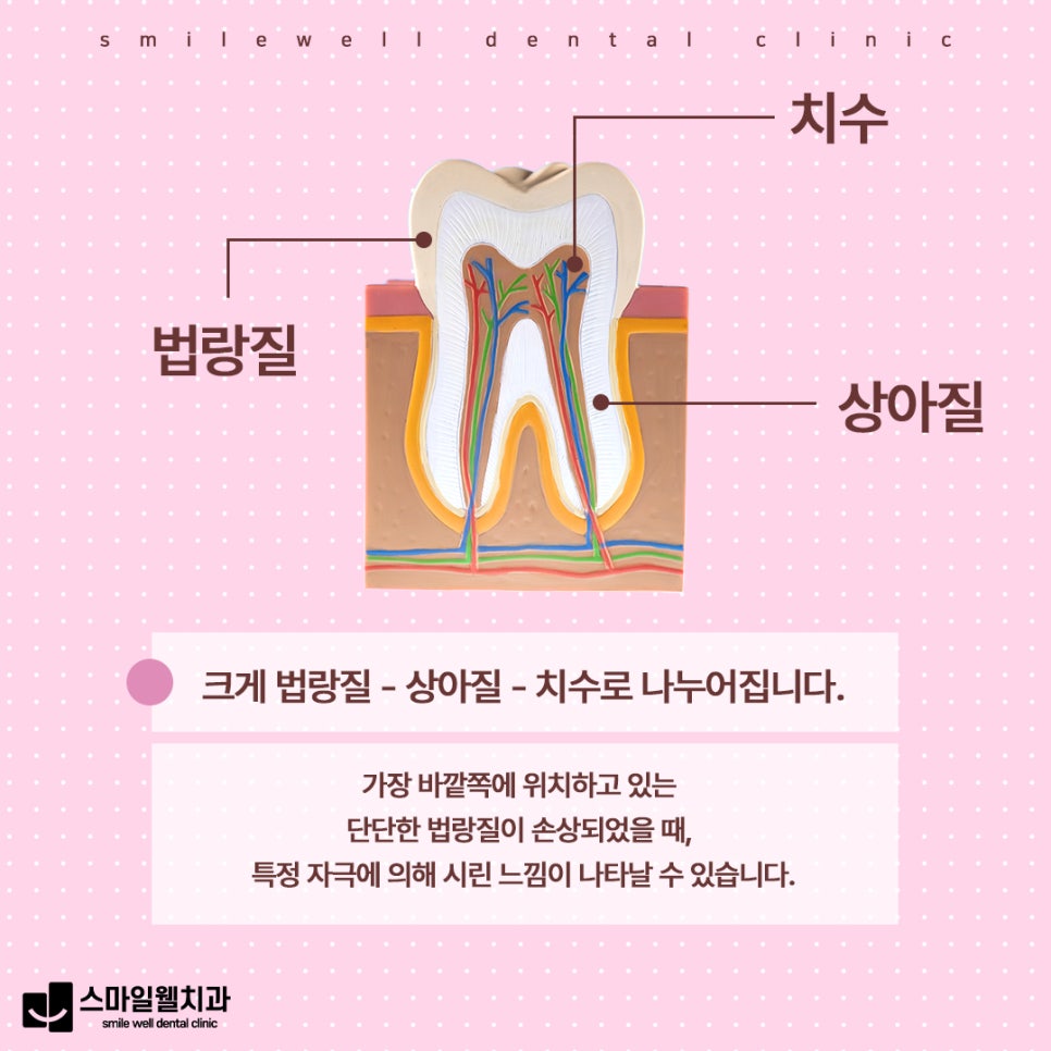 치아 시림 원인, 왜 갑자기 이가 시릴까요? [4가지 주요 이유]