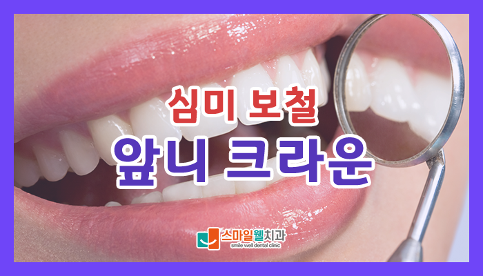 앞니 크라운 종류, 나에게 맞는 심미보철은 무엇일까요?