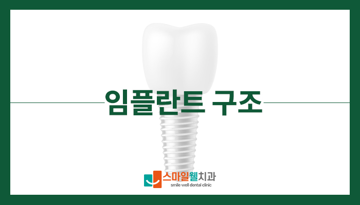 임플란트 구조와 장점, 치과의사가 알려주는 3가지 핵심 요소