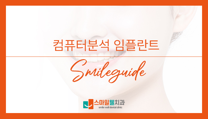 컴퓨터 분석 임플란트, 정확도를 높이는 방법은?