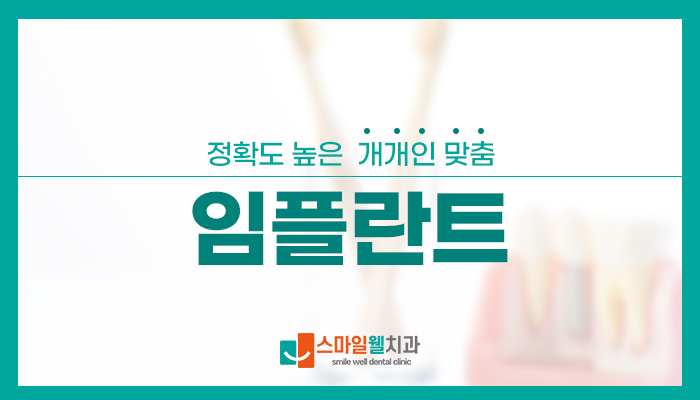맞춤 임플란트, 왜 개인별 지대주가 중요할까요?