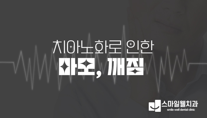 치아 마모와 깨짐, 그대로 두면 안 되는 이유와 치료 방법은?