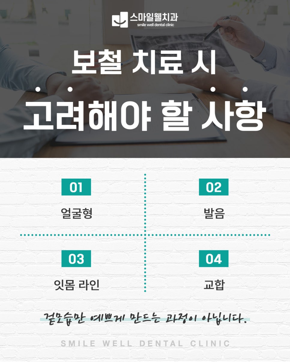 보철치료, 실패 없이 결정하려면? 치과의사가 알려주는 4가지 체크리스트