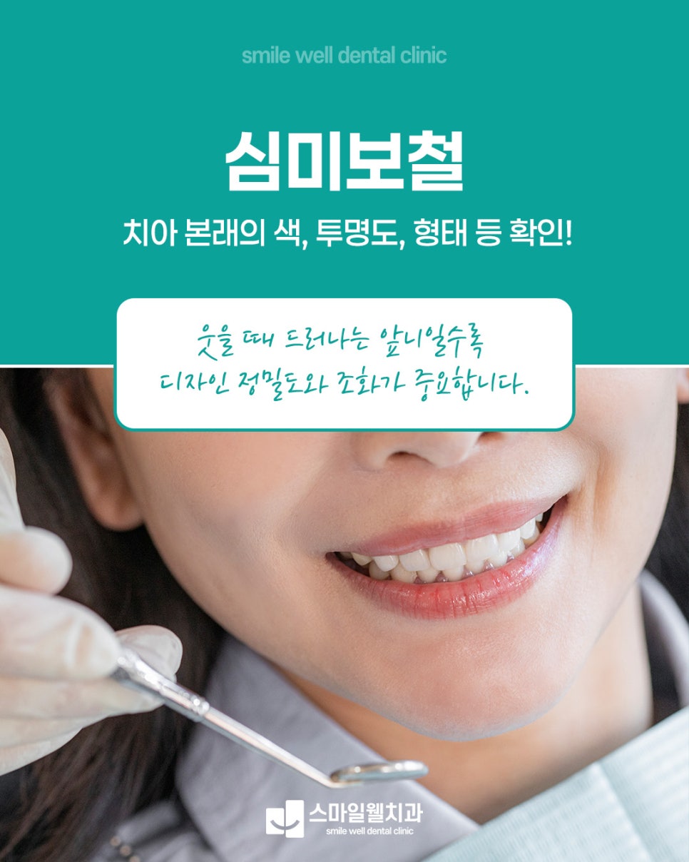심미보철, 자연스러운 앞니를 위한 3가지 핵심 체크리스트