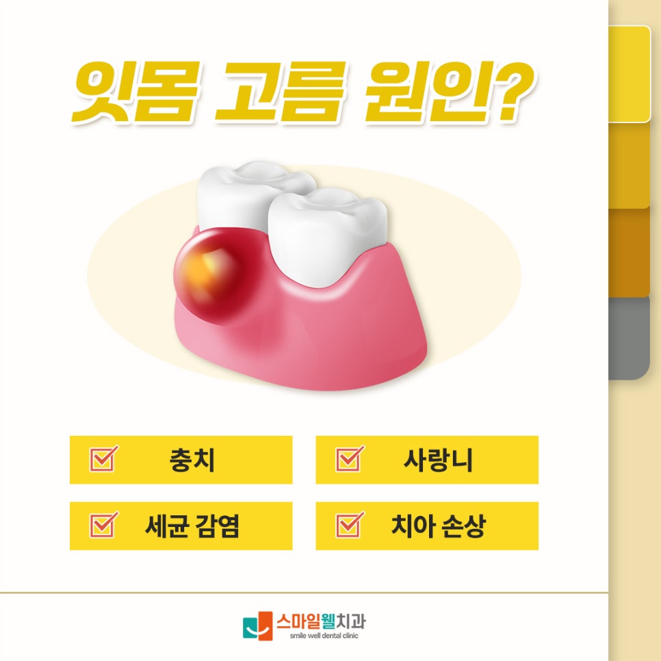 잇몸 고름 원인과 증상, 그대로 두면 치아 상실까지?