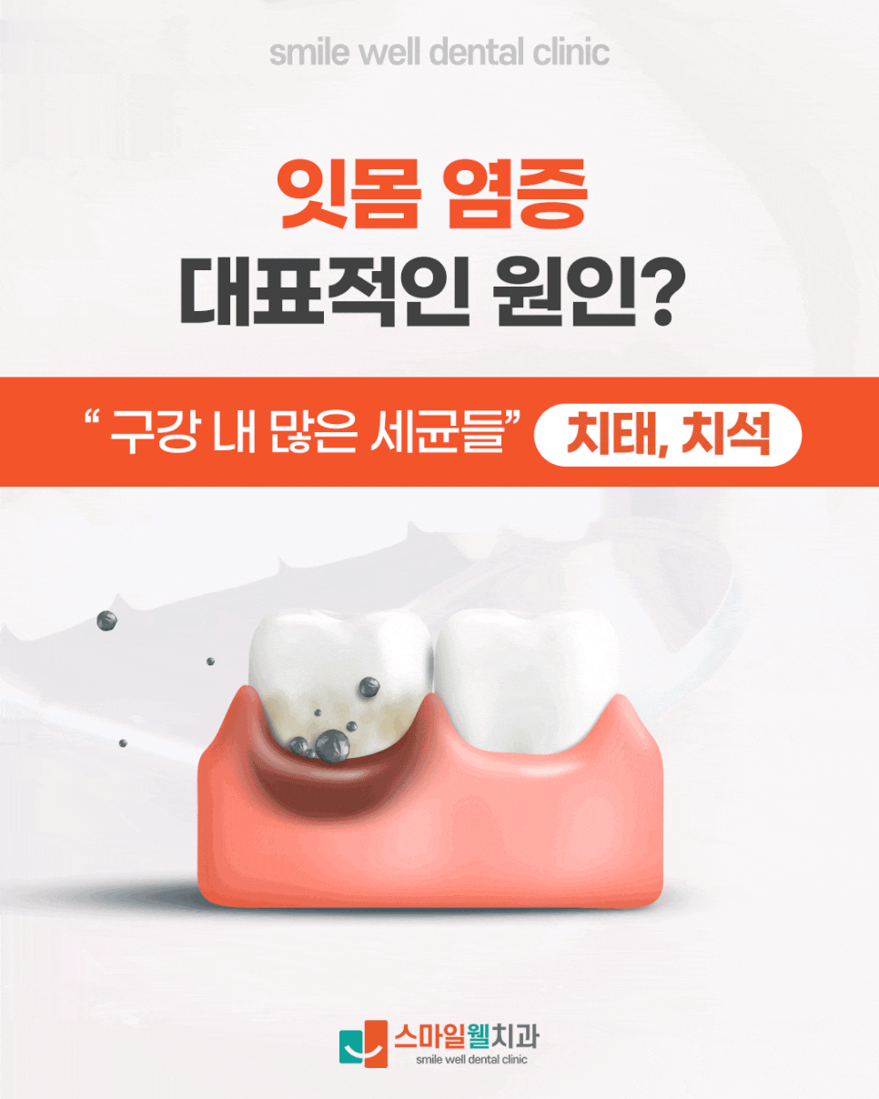 잇몸 염증 초기 증상, 피가 나고 붓는다면 확인하세요