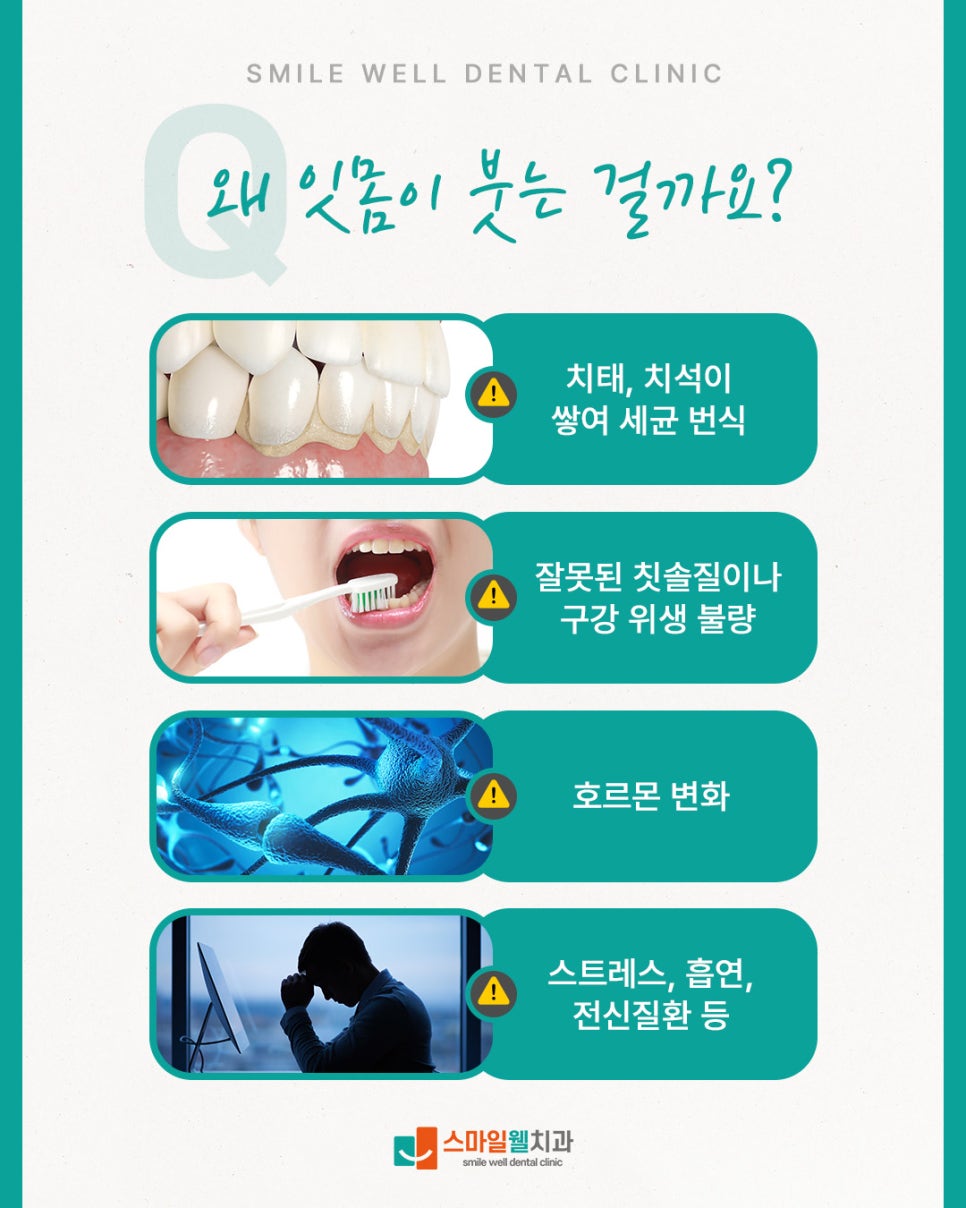 잇몸이 붓는 이유, 그대로 두면 치주염 될까? [원인·관리법]