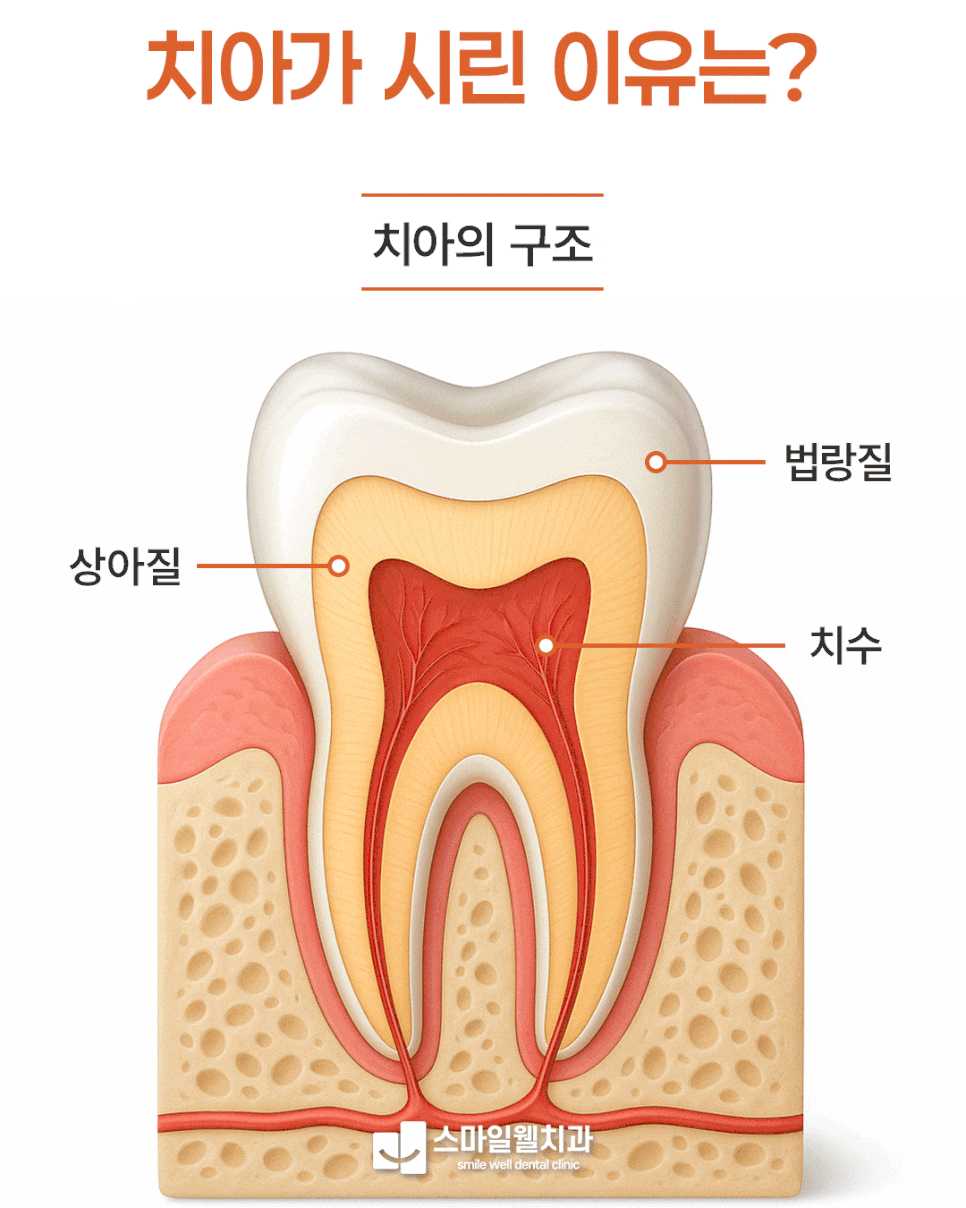 치아가 시려요, 찬물 마실 때 찌릿한 원인 3가지