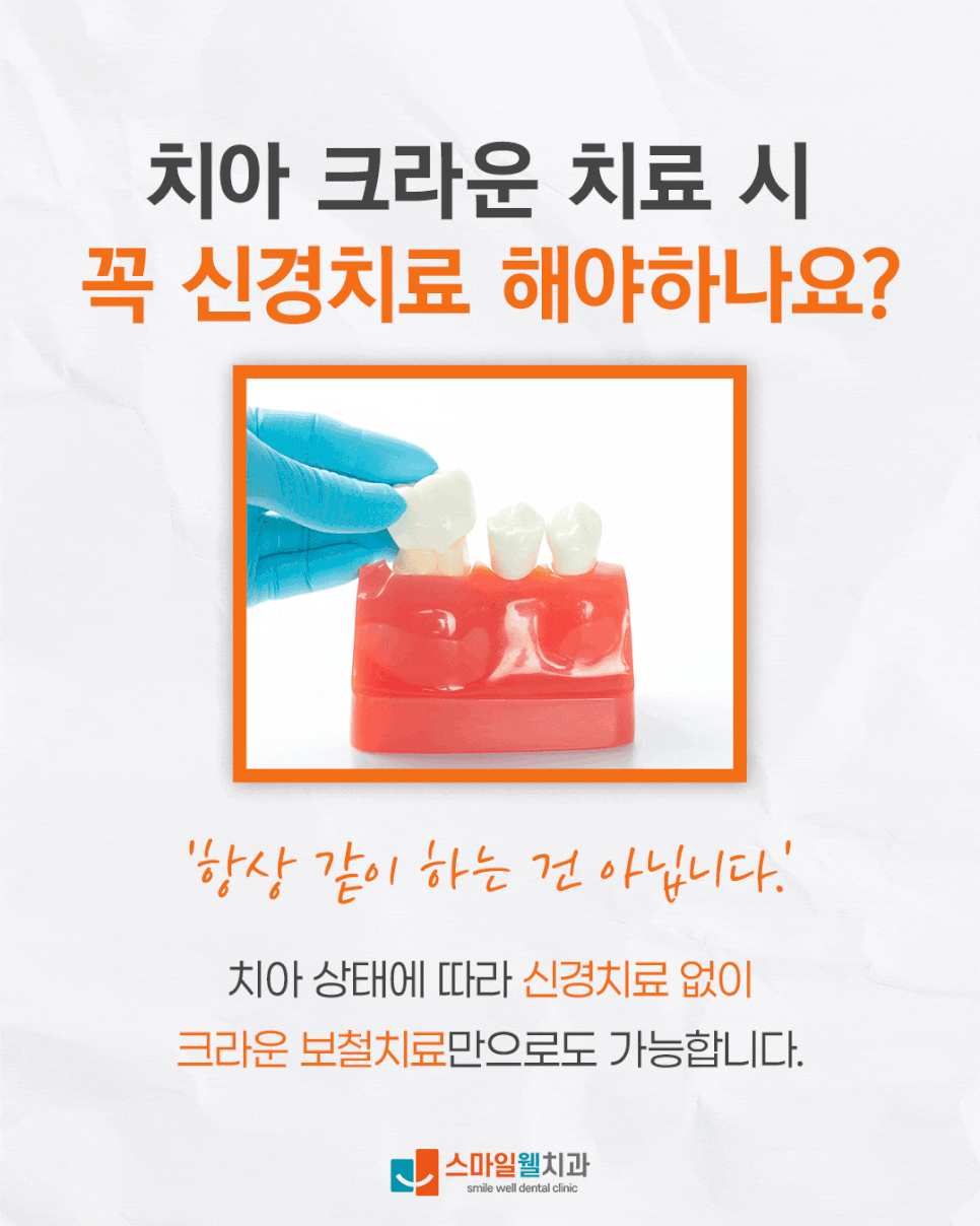 치아 크라운, 꼭 신경치료해야 하나요? [필요 조건 정리]