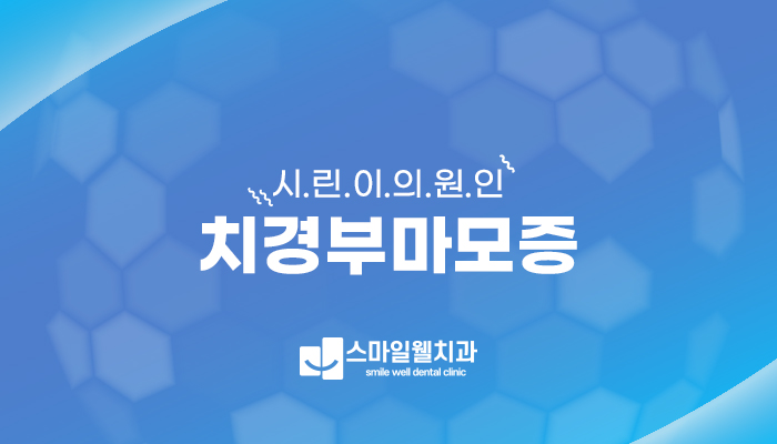 시린이 원인, 치경부마모증 치료 방법은? [레진·GI 비교]