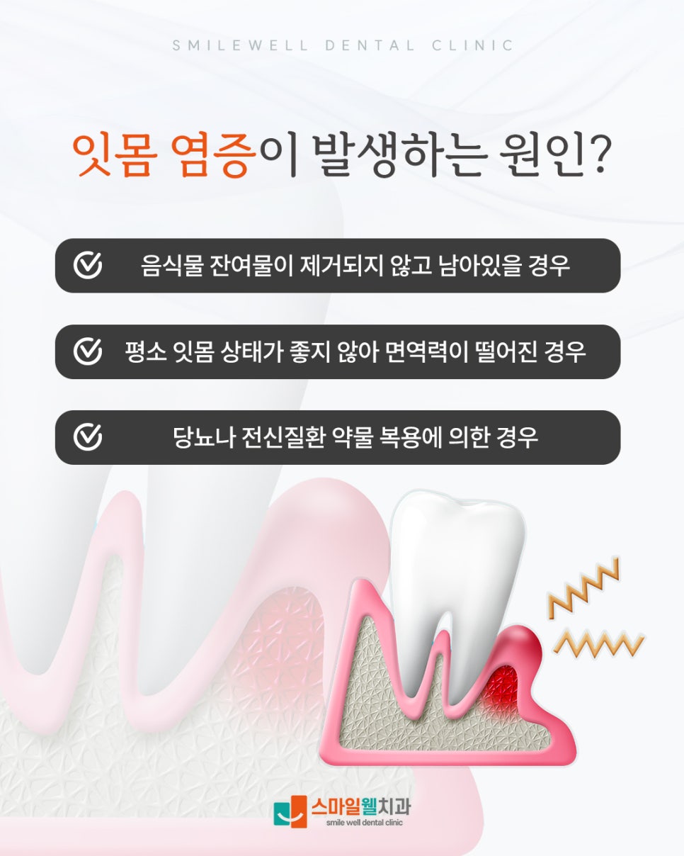 잇몸질환, 붓고 피나는 증상 그대로 두면 안 되는 이유