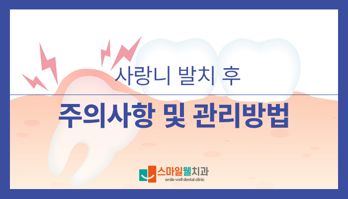 사랑니 발치 후 주의사항, 회복 기간과 관리법은?