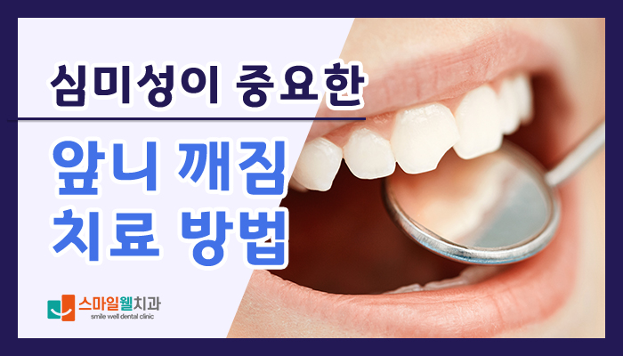 앞니 깨짐 치료, 레진과 라미네이트 중 무엇이 좋을까요?