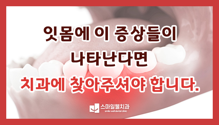 잇몸 염증 증상, 그대로 두면 치아 상실까지? [단계별 원인·치료]