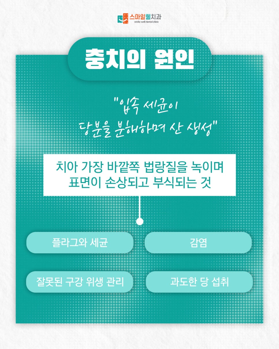충치 치료, 왜 빠를수록 좋을까요? 방치 시 위험성 정리