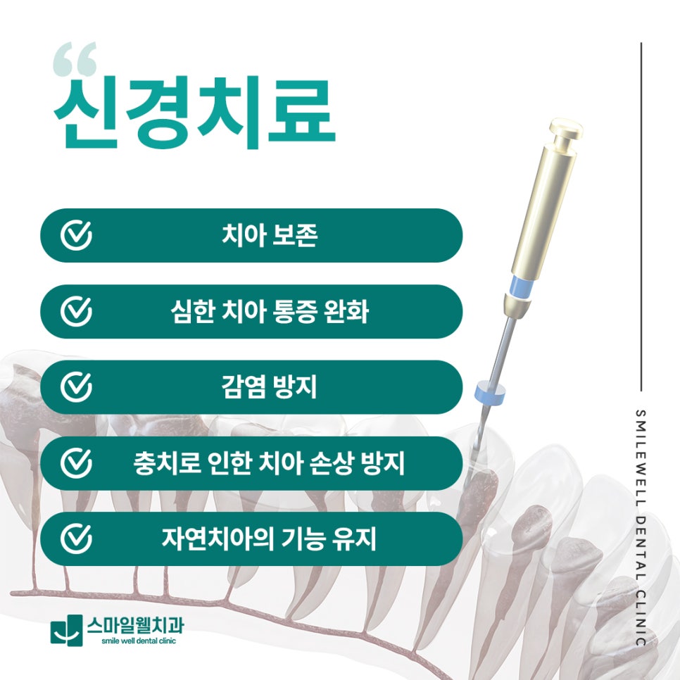신경치료 중단하면 어떻게 되나요? 끝까지 받아야 하는 이유