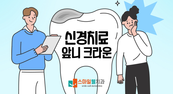 신경치료 후 앞니 크라운, 꼭 씌워야 할까요? [필요성·주의사항]