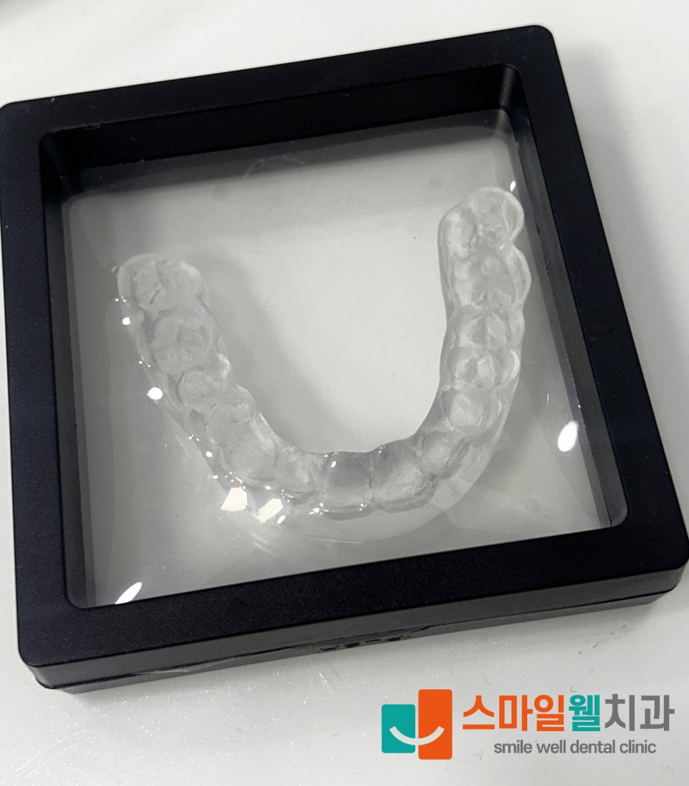 이갈이 그대로 두면 치아 마모 위험? 나이트 가드 효과 정리