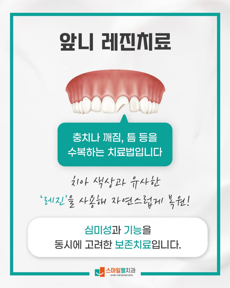 앞니 레진 치료, 벌어진 틈과 깨진 부위 해결 방법은?