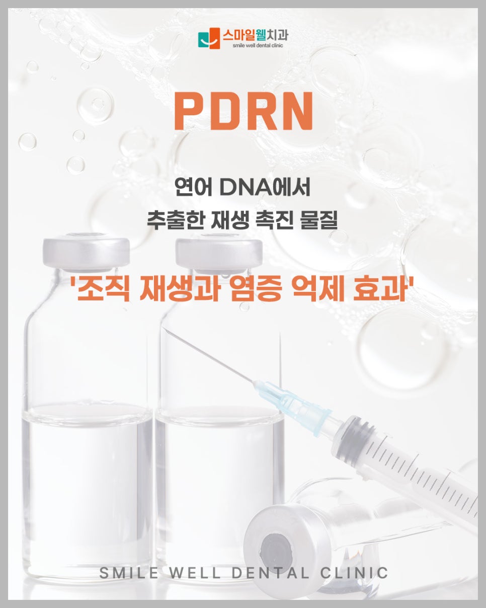 잇몸치료 PDRN 주사 효과, 재생과 염증 완화에 도움 될까?