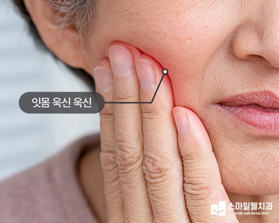 잇몸이 욱신거리는 이유, 치과의사가 알려주는 3가지 원인
