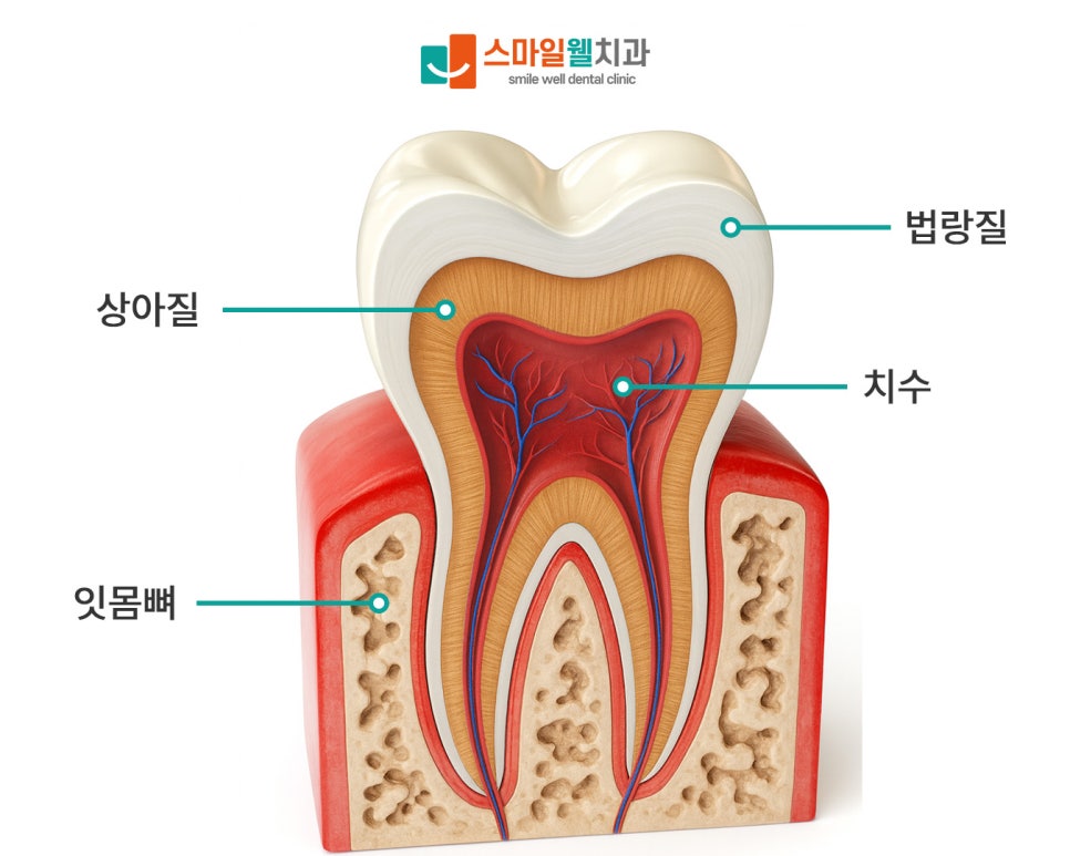 초기 충치, 통증 없어도 치료해야 할까요? [증상·관리법]